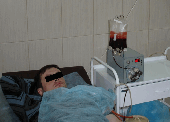Autohemotherapy